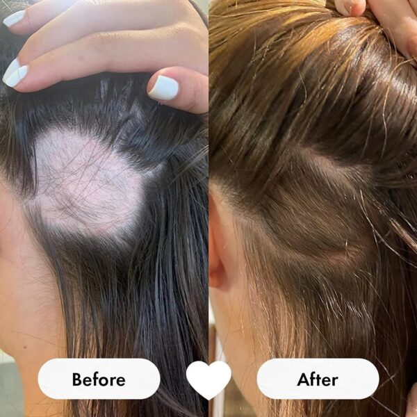 Biotin Gummies for Hair, Skin & Nail Support